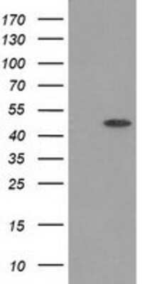 Western Blot: PACSIN3 Antibody (OTI2A3) [NBP2-03477]