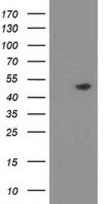 Western Blot: PACSIN3 Antibody (OTI4F8) [NBP2-03475]