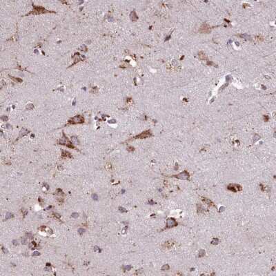 Immunohistochemistry-Paraffin: PACSIN3 Antibody [NBP2-47339]