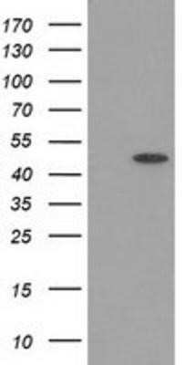 Western Blot: PACSIN3 Antibody (OTI2A3)Azide and BSA Free [NBP2-73223]