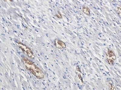 Immunohistochemistry-Paraffin: PACSIN3 Antibody (S04-1F1) [NBP3-19817]