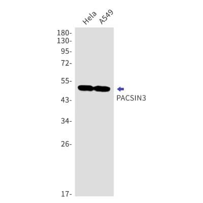 Western Blot: PACSIN3 Antibody (S04-1F1) [NBP3-19817]