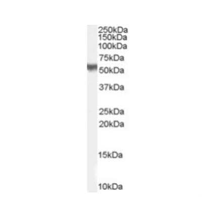 Western Blot: PACSIN3 Antibody [NB100-862]