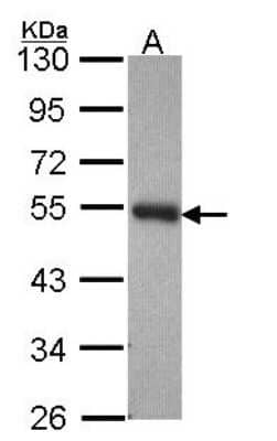 Western Blot: PACSIN3 Antibody [NBP2-19673]