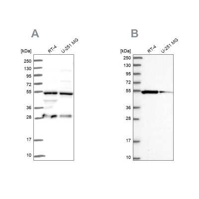 Western Blot: PACSIN3 Antibody [NBP2-47339]