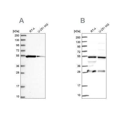 Western Blot: PACSIN3 Antibody [NBP2-48707]