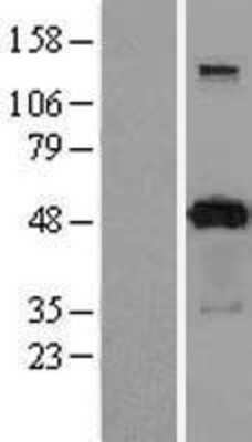 Western Blot: PACSIN3 Overexpression Lysate [NBL1-14060]