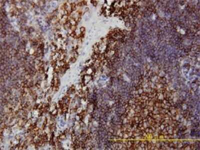 Immunohistochemistry-Paraffin: PACT Antibody (1B9-1A7) [H00008575-M01]