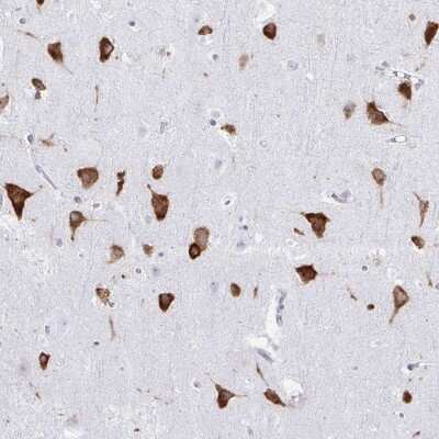 Immunohistochemistry-Paraffin: PACT Antibody [NBP2-55123]