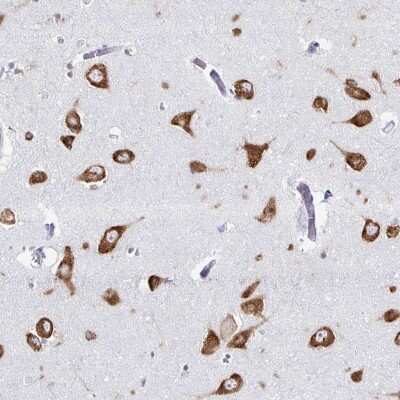 Immunohistochemistry-Paraffin: PACT Antibody [NBP2-55124]