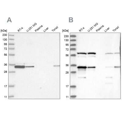 Western Blot: PACT Antibody [NBP2-55123]