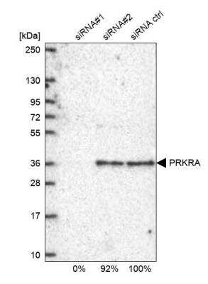 Western Blot: PACT Antibody [NBP2-55124]