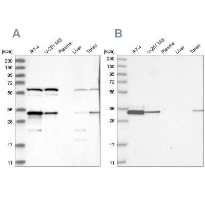 Western Blot: PACT Antibody [NBP2-55124]