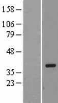 Western Blot: PACT Overexpression Lysate [NBL1-14784]