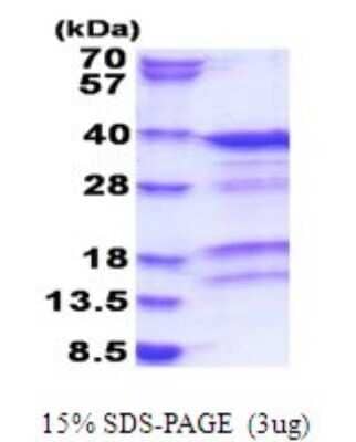 SDS-PAGE: Recombinant Human PACT His Protein [NBP2-51787]