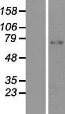 Western Blot: PADI2 Overexpression Lysate [NBP2-10366]