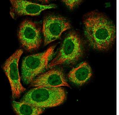 Immunocytochemistry/ Immunofluorescence: PAD3 Antibody [NBP1-92240]
