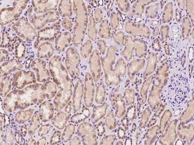 Immunohistochemistry-Paraffin: PAD3 Antibody [NBP2-97680]