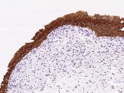 Immunohistochemistry-Paraffin: PAD3 Antibody [NBP2-97680]