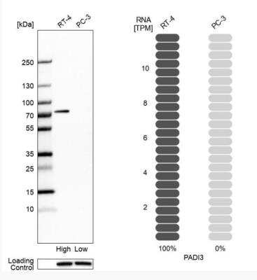 Western Blot: PAD3 Antibody [NBP1-92240]