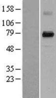 Western Blot: PADI4 Overexpression Lysate [NBL1-14061]