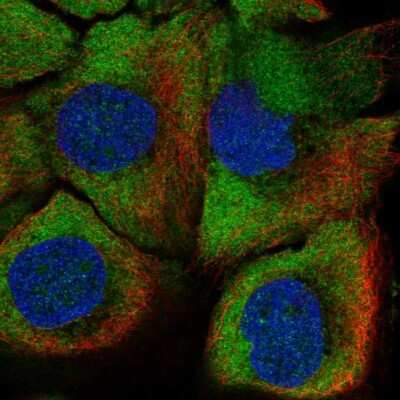 Immunocytochemistry/ Immunofluorescence: PADI1 Antibody [NBP2-37761]