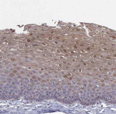 Immunohistochemistry-Paraffin: PADI1 Antibody [NBP2-37761]