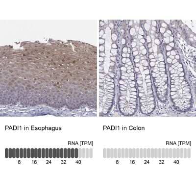 Immunohistochemistry-Paraffin: PADI1 Antibody [NBP2-37761]