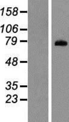 Western Blot: PADI1 Overexpression Lysate [NBP2-07421]