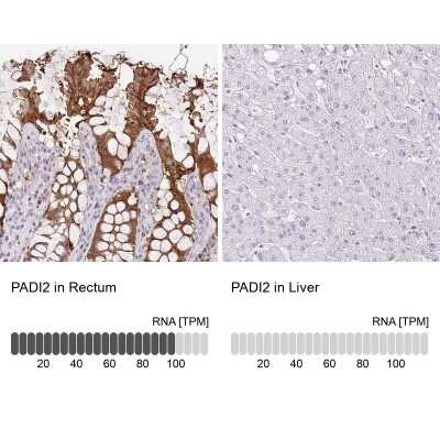 Immunohistochemistry-Paraffin: PADI2 Antibody [NBP2-37918]