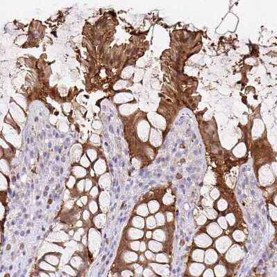 Immunohistochemistry-Paraffin: PADI2 Antibody [NBP2-37918]