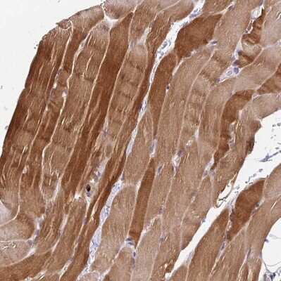 Immunohistochemistry-Paraffin: PADI2 Antibody [NBP2-37918]