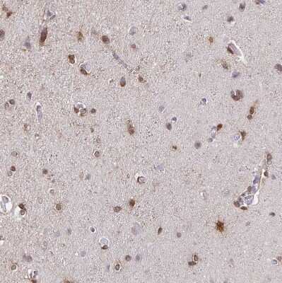 Immunohistochemistry-Paraffin: PADI2 Antibody [NBP2-37918]