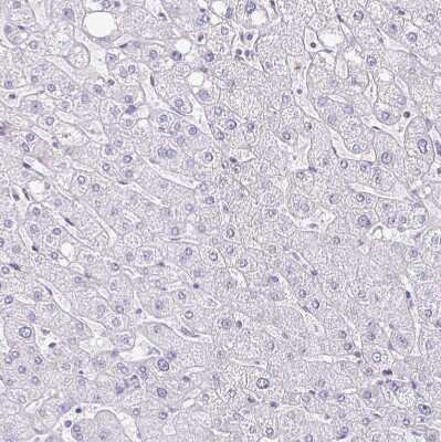 Immunohistochemistry-Paraffin: PADI2 Antibody [NBP2-37918]