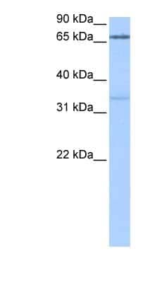 Western Blot: PADI2 Antibody [NBP1-54958]