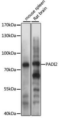 Western Blot: PADI2 AntibodyAzide and BSA Free [NBP2-93672]