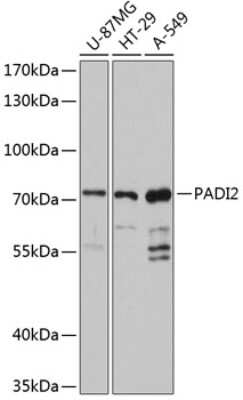 Western Blot: PADI2 AntibodyAzide and BSA Free [NBP2-93929]