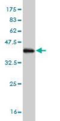 Western Blot: PADI4 Antibody (4D8) [H00023569-M01]