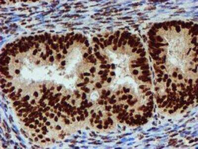 Immunohistochemistry-Paraffin: PADI4 Antibody (OTI4H5) [NBP2-02082]