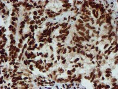 Immunohistochemistry-Paraffin: PADI4 Antibody (OTI4H5) [NBP2-02082]