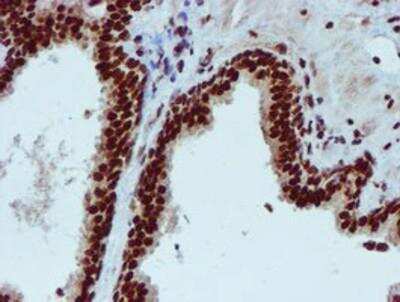 Immunohistochemistry-Paraffin: PADI4 Antibody (OTI4H5) [NBP2-02082]