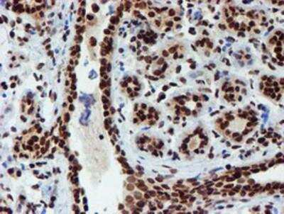 Immunohistochemistry-Paraffin: PADI4 Antibody (OTI4H5) [NBP2-02082]