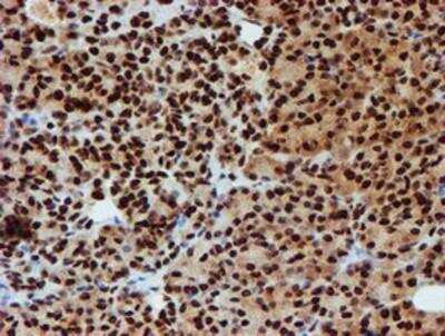 Immunohistochemistry-Paraffin: PADI4 Antibody (OTI4H5) [NBP2-02082]