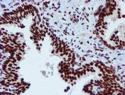 Immunohistochemistry-Paraffin: PADI4 Antibody (OTI4H5) [NBP2-02082]