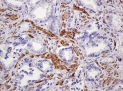 Immunohistochemistry: PADI4 Antibody (OTI5C10) [NBP2-46310]