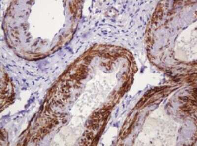 Immunohistochemistry: PADI4 Antibody (OTI5C10) [NBP2-46310]