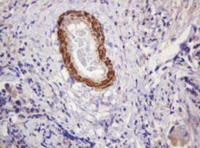 Immunohistochemistry-Paraffin: PADI4 Antibody (OTI5C10) [NBP2-46310]