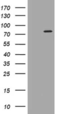 Western Blot: PADI4 Antibody (OTI5C10) [NBP2-46310]