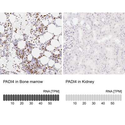 Immunohistochemistry-Paraffin: PADI4 Antibody [NBP1-87353]