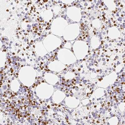 Immunohistochemistry-Paraffin: PADI4 Antibody [NBP1-87353]